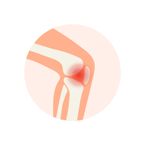 膝關節痛插圖