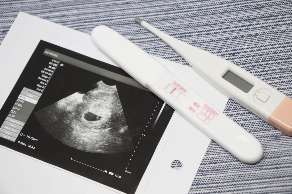 驗孕棒及產檢照片