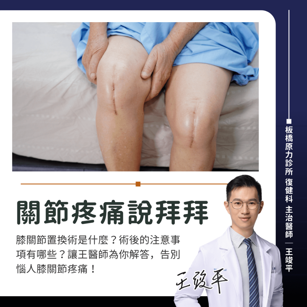膝關節置換術