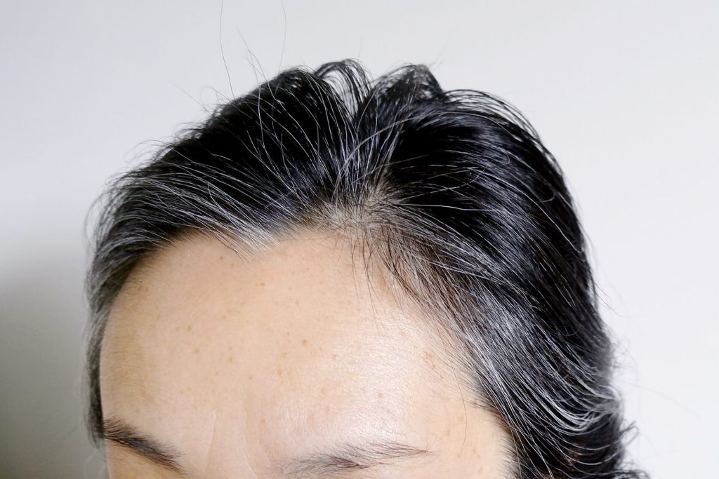 髮際線上白髮的婦女