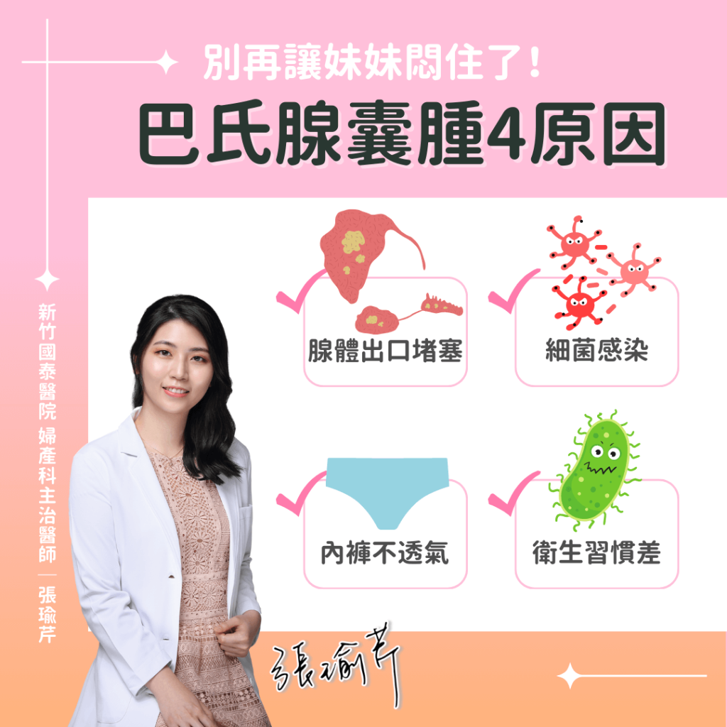 巴氏腺囊腫