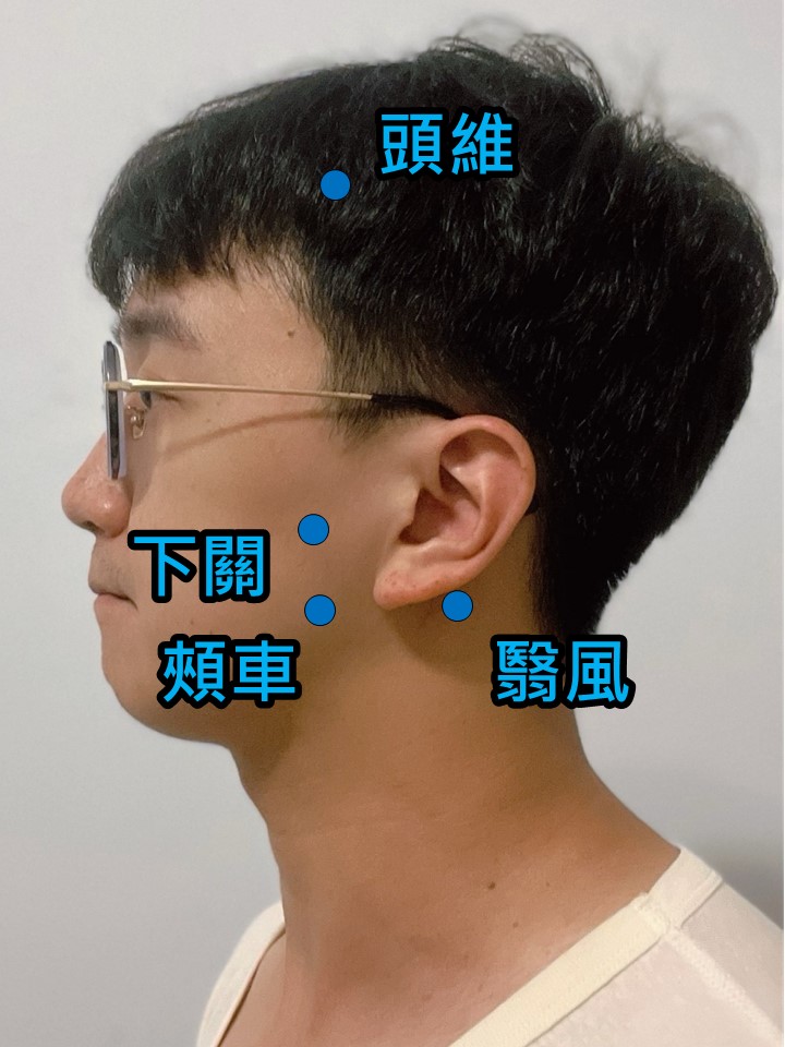 針灸下關、翳風、頭維、頰車等穴位，以放鬆顳肌、咬肌及外翼肌，並依個人體質搭配疏經活血等藥方加速康復。