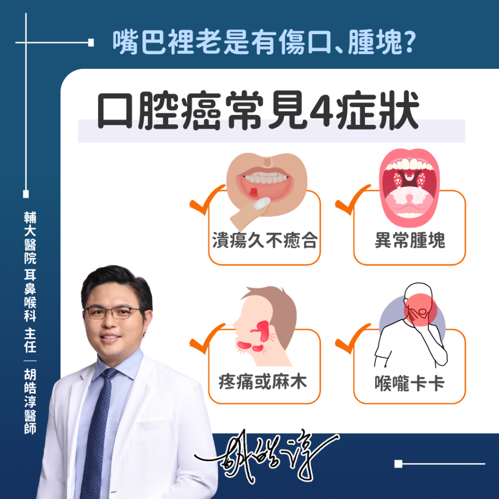口腔癌常見四症狀