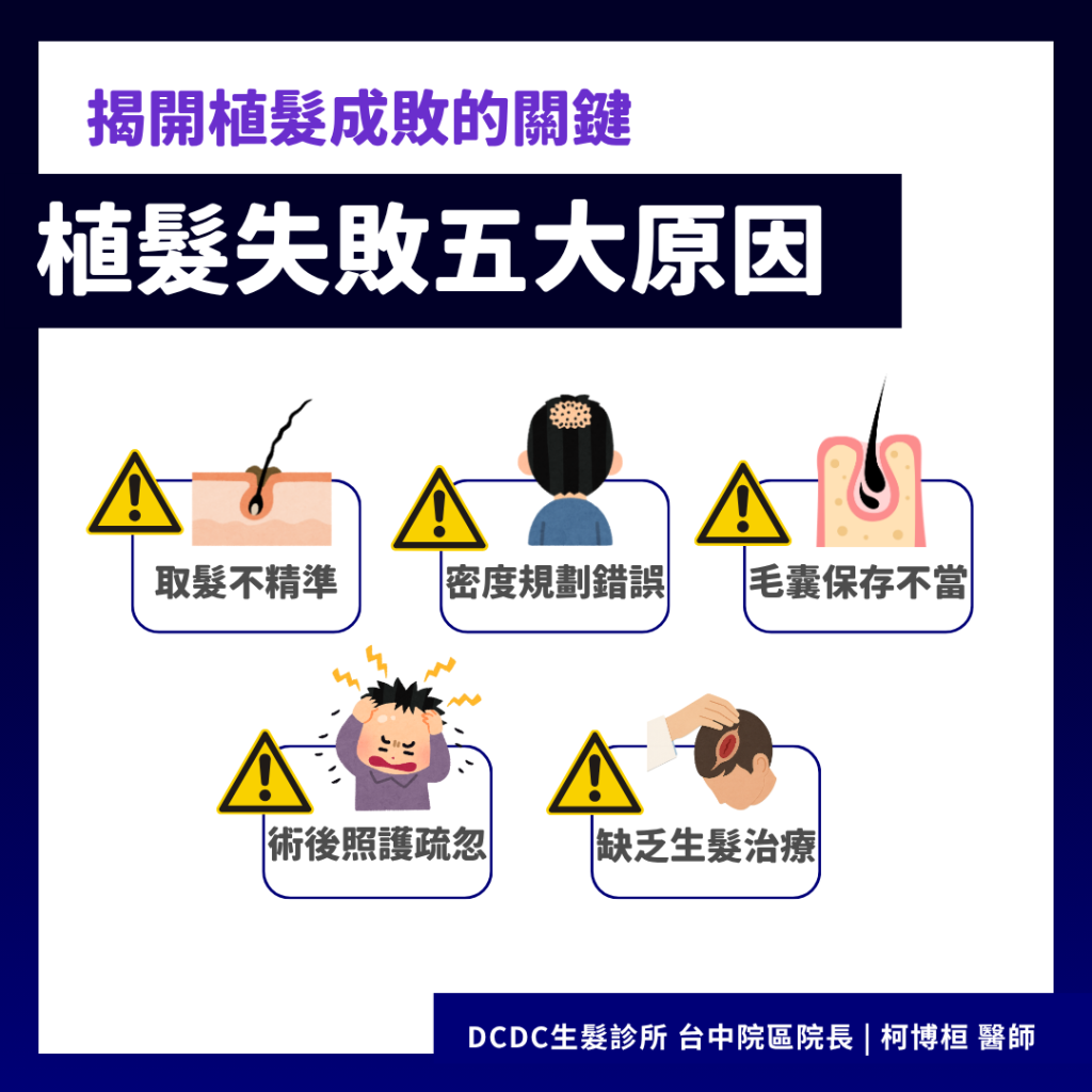 植髮失敗五大原因