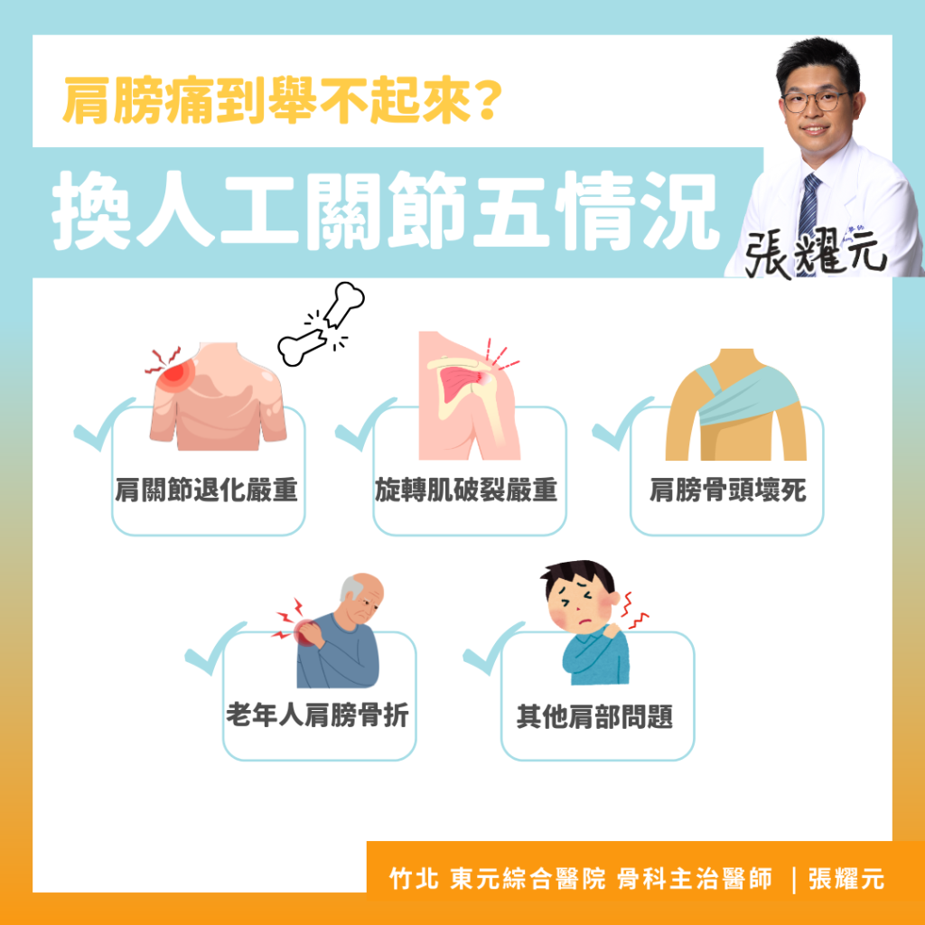 換人工關節五情況