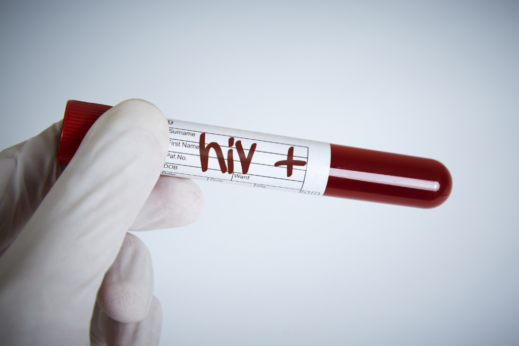 HIV高風險者應定時前往篩檢