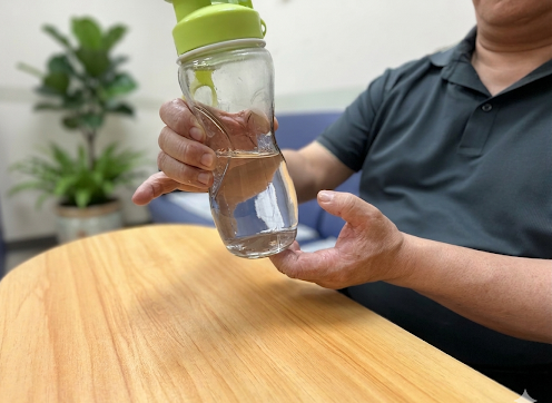 類風溼性關節炎造成手指關節腫脹、變形與疼痛,連拿水杯都吃力。(情境圖,非當事人)