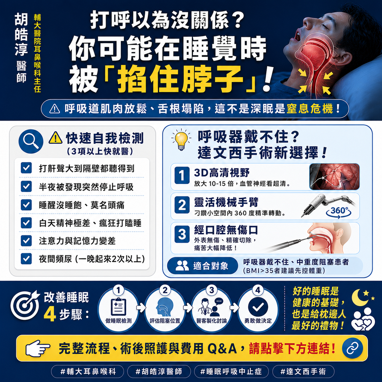 達文西手術能治療睡眠呼吸中止症