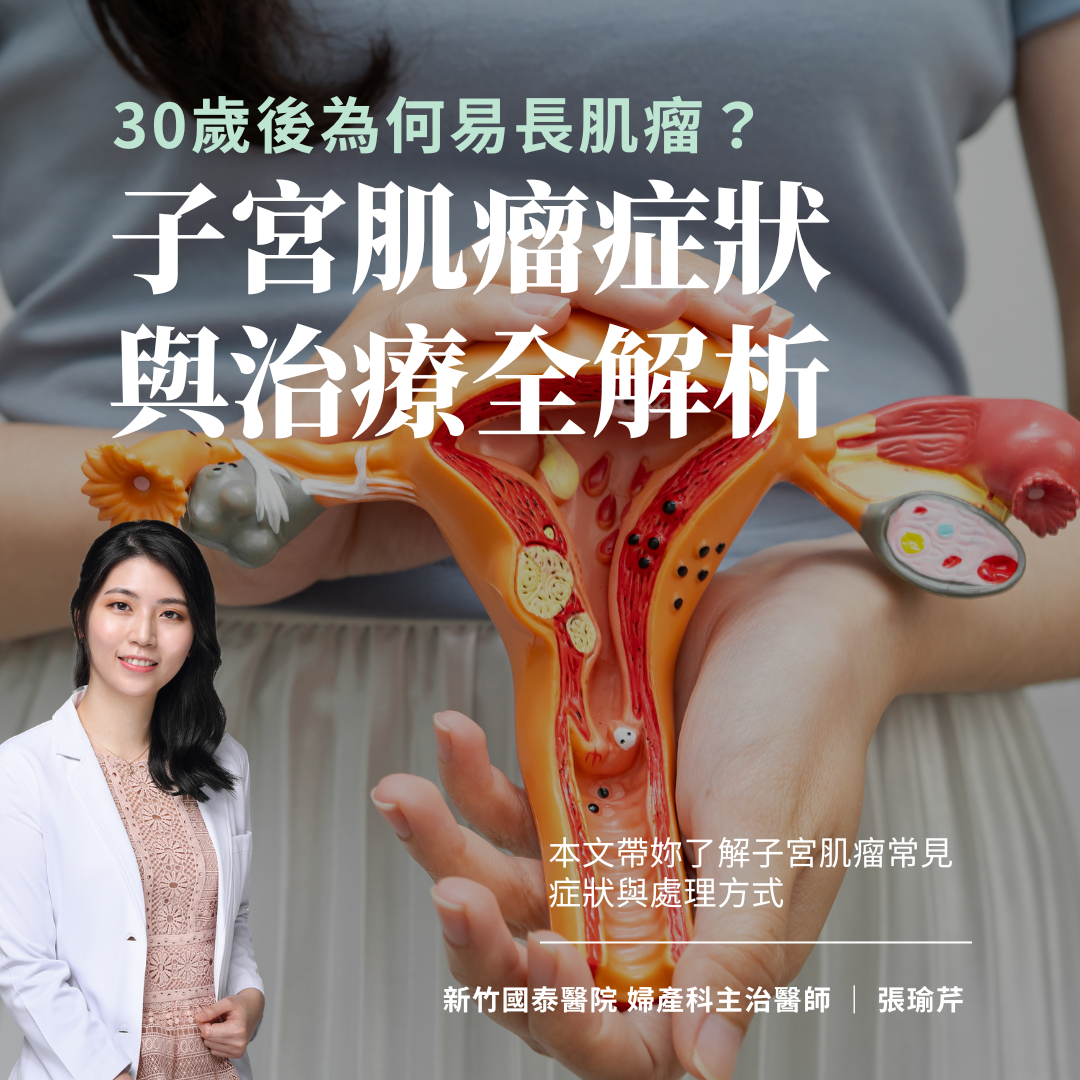 子宮肌瘤症狀與治療解析