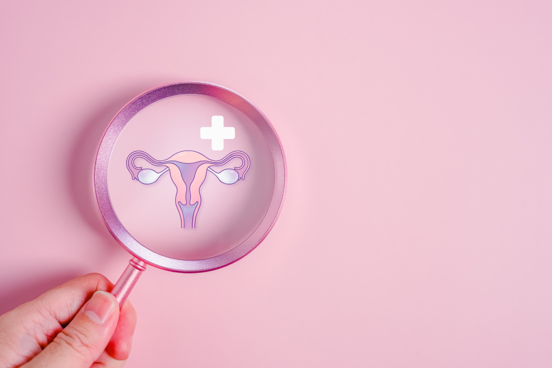 多囊性卵巢（PCOS）是什麼？2026 年正式更名 PMOS，會導致不孕嗎？