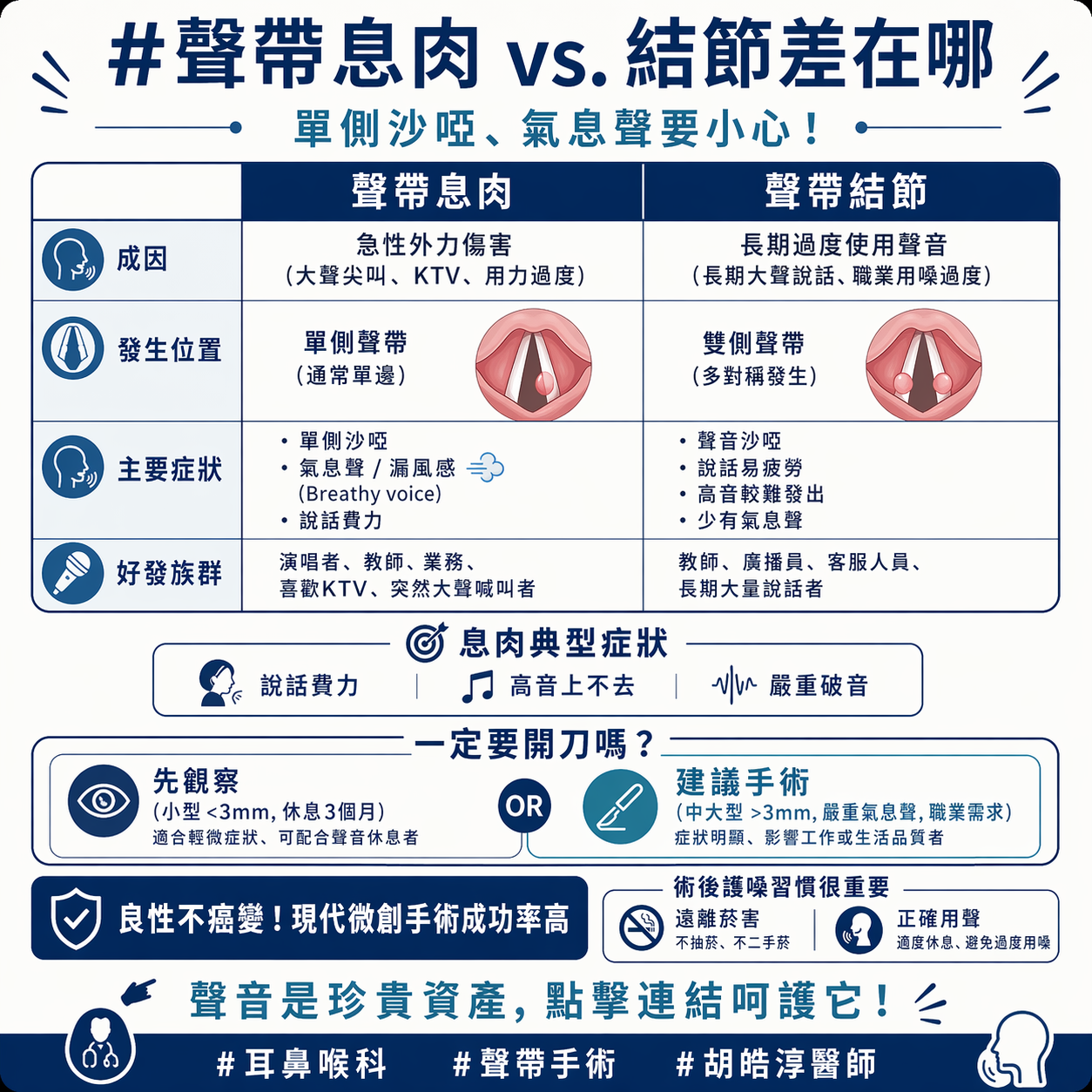 聲帶息肉是什麼?跟結節有何不同?